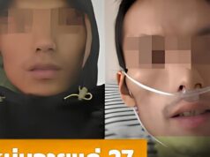 อุทาหรณ์ หนุ่มวัย 27 ป่วยมะเร็งระยะสุดท้าย หลังกิน “เมนูเดิม” ทุกคืน อาหารโปรดคนไทย!