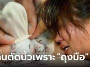 แม่ร้องไห้โฮ ลูกเพิ่งเกิดได้ 6 วัน โดนตัดนิ้วทิ้ง ต้นเหตุสลด “ถุงมือ” ที่ย่าสั่งให้สวมไว้ตลอด