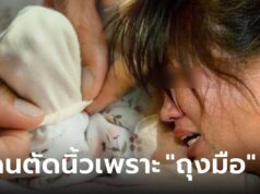 แม่ร้องไห้โฮ ลูกเพิ่งเกิดได้ 6 วัน โดนตัดนิ้วทิ้ง ต้นเหตุสลด “ถุงมือ” ที่ย่าสั่งให้สวมไว้ตลอด