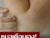 ควรระวัง!! ร่างกายมีอาการคัน 2 ส่วนนี้ อาจเป็นสัญญาณของ “มะเร็งตับ” ไม่ใช่อาการแพ้