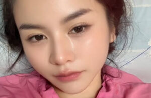 อาการล่าสุด “แอร์ พรสวรรค์” รถชนพังยับ โอดเจ็บสุดในชีวิต