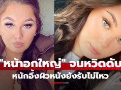 สาววัย 21 ทนทุกข์ “หน้าอกโต” หนักจนผิวหนังขาด! แต่กฎหมายตลกร้าย ไม่ให้ผ่าลดขนาด