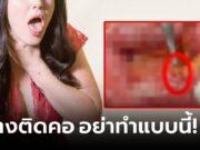 ความเชื่อผิดๆ “ก้างปลาติดคอ” หญิงกลืนข้าวดันลงท้อง สยองกว่าเดิมต้องทำ “ทวารเทียม”