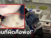 พ่อด่าเดือด ลูกสาววัย 15 บนคอมี “รอยช้ำสีแดง” เจอร่ายยาวโต้กลับ ปัญหาเกิดจากใคร?!