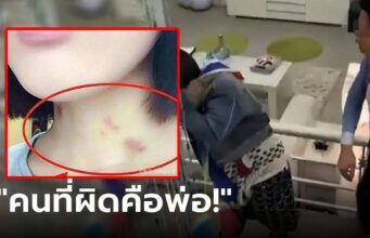 พ่อด่าเดือด ลูกสาววัย 15 บนคอมี “รอยช้ำสีแดง” เจอร่ายยาวโต้กลับ ปัญหาเกิดจากใคร?!
